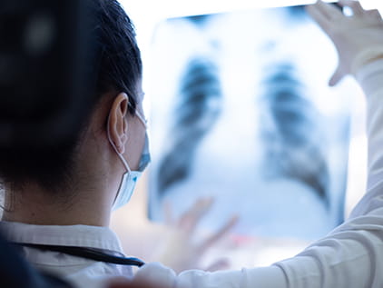 Doctor examining chest imaging