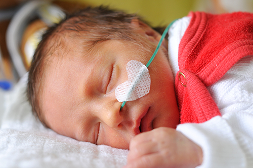 Newborn baby with feeding tube